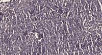 ARI1A Polyclonal Antibody