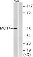 MCT4 Polyclonal Antibody