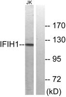 MDA5 Polyclonal Antibody