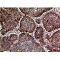 MDA-7 Polyclonal Antibody