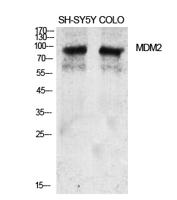 MDM2 Polyclonal Antibody
