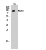 MDM2 Polyclonal Antibody