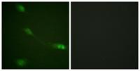 MDM2 Polyclonal Antibody