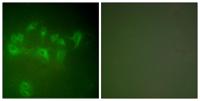 MDM2 Polyclonal Antibody