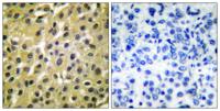 MDM2 Polyclonal Antibody
