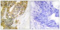 MDM2 Polyclonal Antibody