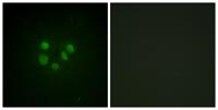 BLM Polyclonal Antibody