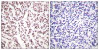 BLM Polyclonal Antibody