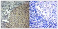 BLNK Polyclonal Antibody