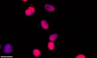 BM28 Polyclonal Antibody