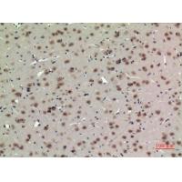 BMAL1 Polyclonal Antibody