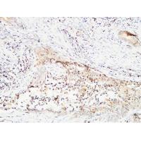 BMP-15 Polyclonal Antibody