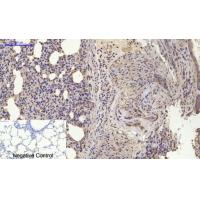 BMP-2 Polyclonal Antibody