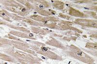 BMP-2 Polyclonal Antibody