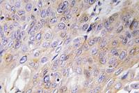 BMP-3 Polyclonal Antibody