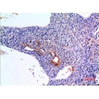BMP-3A Polyclonal Antibody
