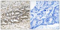 MDMX Polyclonal Antibody