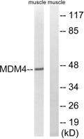 MDMX Polyclonal Antibody