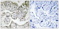 ME2 Polyclonal Antibody