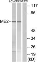 ME2 Polyclonal Antibody