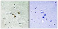 ME3 Polyclonal Antibody