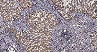 ATP5G1 Polyclonal Antibody