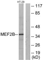 MEF-2B Polyclonal Antibody
