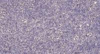 MEF-2B Polyclonal Antibody