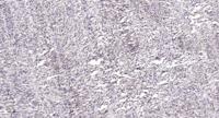 MEF-2C Polyclonal Antibody