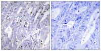 MEF-2D Polyclonal Antibody