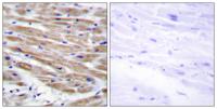 MEK Kinase-4 Polyclonal Antibody
