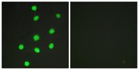 GLI-3 Polyclonal Antibody