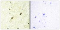 GLI-3 Polyclonal Antibody