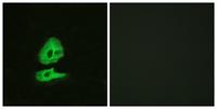 Glucagon Receptor Polyclonal Antibody