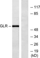 Glucagon Receptor Polyclonal Antibody