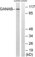 Glucosidase IIα Polyclonal Antibody