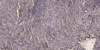 Glucosidase IIα Polyclonal Antibody
