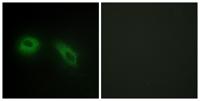 Glucosidase IIβ Polyclonal Antibody