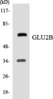 Glucosidase IIβ Polyclonal Antibody
