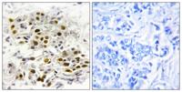 MEK Kinase-6 Polyclonal Antibody