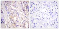 MEK-1 Polyclonal Antibody
