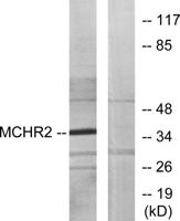 MCH-2R Polyclonal Antibody