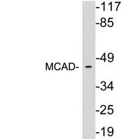 MCAD Polyclonal Antibody