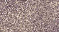 MCAD Polyclonal Antibody