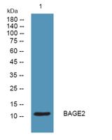 BAGE2 Polyclonal Antibody