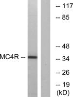 MC4-R Polyclonal Antibody