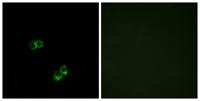 MC5-R Polyclonal Antibody