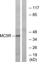 MC5-R Polyclonal Antibody