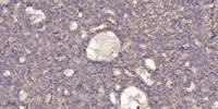 MC5-R Polyclonal Antibody