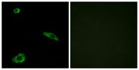 MC2-R Polyclonal Antibody
